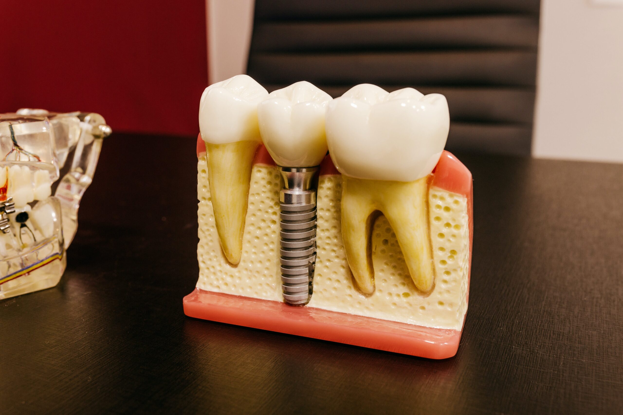 The Best Implant Dentist in Las Vegas